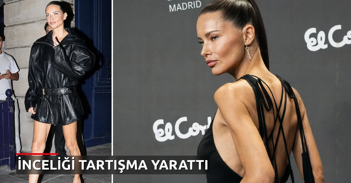 Adriana Lima'nın son hali tartışma yarattı: Bacakları sosyal medyayı ikiye böldü