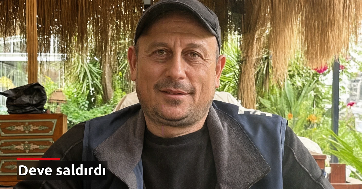 Sevmek istediği deve ısırdı: Hayati tehlikesi var